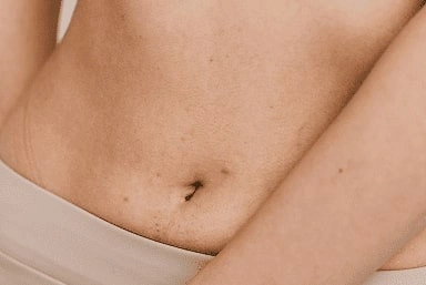 fertility preservation